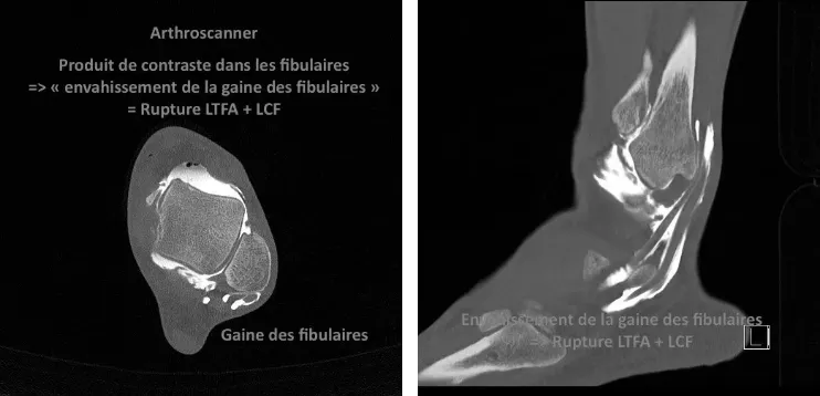 Arthroscanner - Imageries